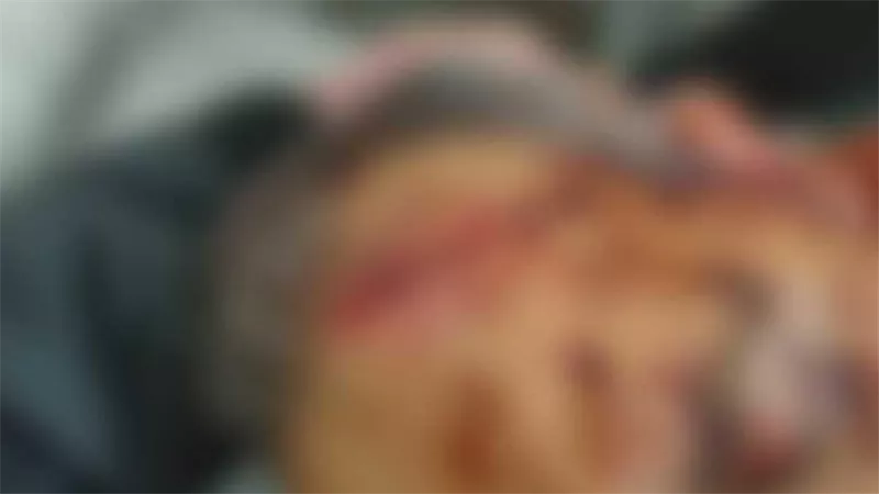 النسايب وقعوا في بعض.. معركة بالشوم والسلاح بسبب خلاف على وزن خاتم ذهب بالفيوم