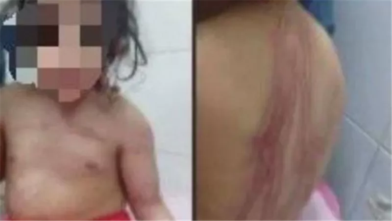  أمها مدمنة.. القصة الكاملة لمأساة طفلة الوراق