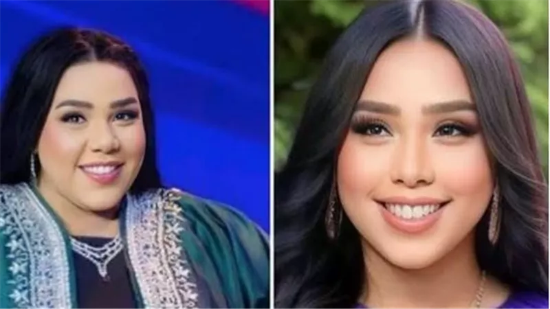 بعد عملية التكميم.. شيماء سيف تثير الجدل بصورها قبل وبعد خسارة الوزن | شاهد