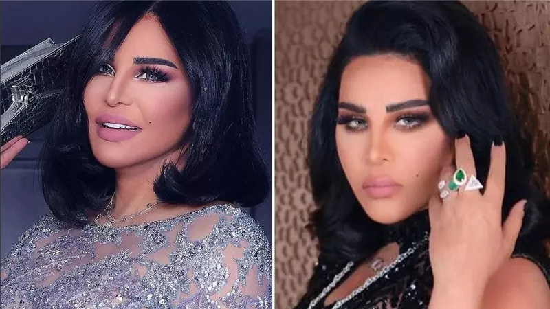 ملامح غريبة.. صور أحلام قبل وبعد عمليات التجميل | شاهد