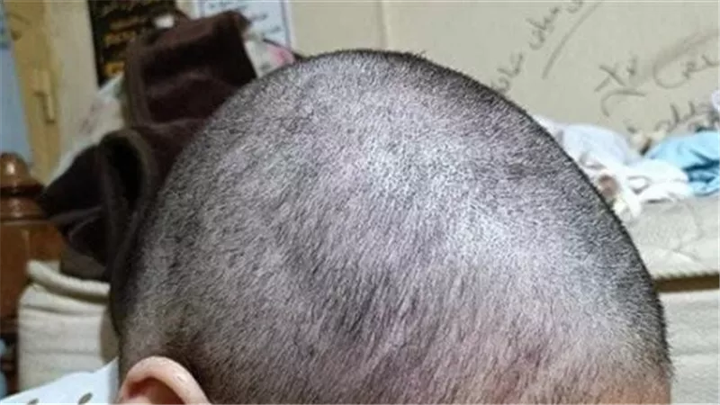 حلقوا لها شعرها علشان الحجاب.. قرار عاجل بشأن واقعة فتاة المقطم