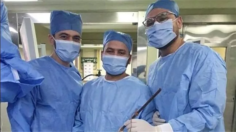 تفاصيل جراحة خطيرة لاستخراج سيخ حديد من عظام حوض طفل بقصر العيني (صور)