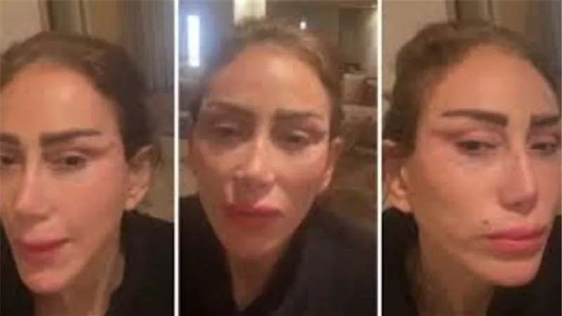  دمرت حياتي.. القصة الكاملة لتشويه ريهام سعيد على يد طبيب تجميل بعد إحالته للمحاكمة 