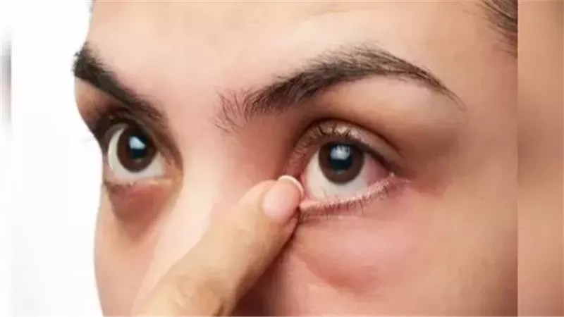  انتبه إليها.. علامة في عينيك تنذر باقتراب إصابتك بسكتة دماغية 
