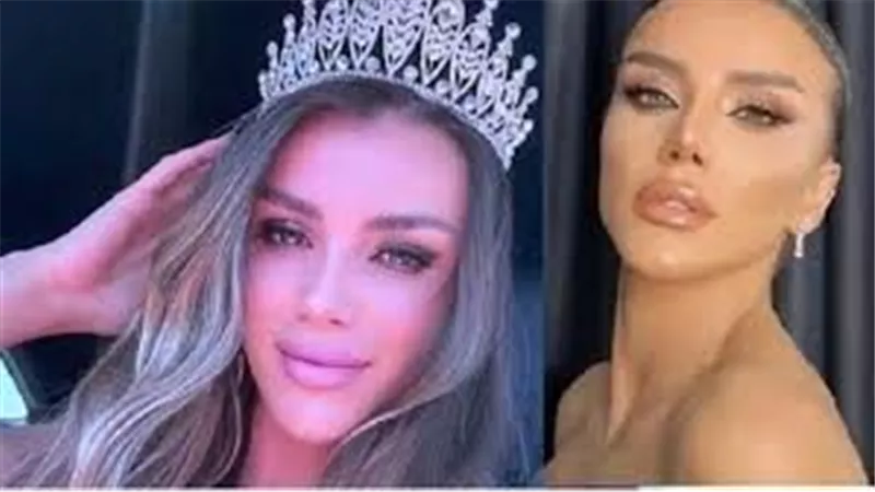  نهاية غير متوقعة.. قصة وفاة ملكة جمال أوروبا التى أثارت العالم 