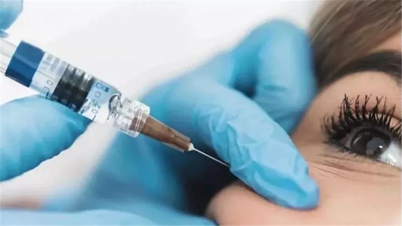 استعدادًا للزواج.. القصة الكاملة لوفاة عروس التجمع بسبب حقنة فيلر