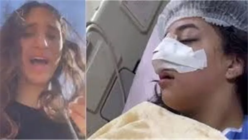  اعوجاج بالأنف.. مفاجأة صادمة بشأن الطالبة كارما ضحية طالبات التجمع الخامس 