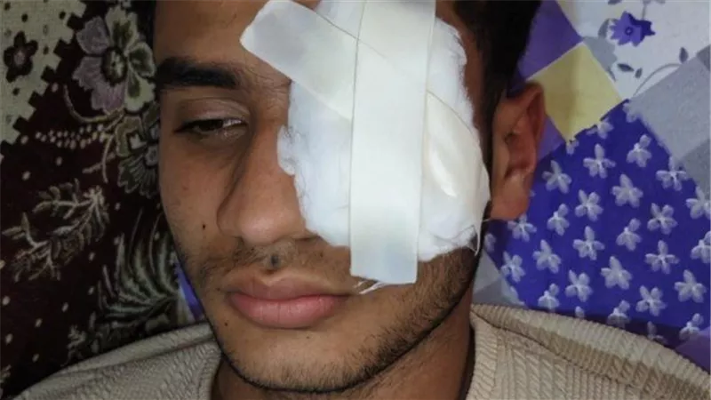  بعد رفضه لعن السيدات في شرفهن.. بطل الشهامة يفقد بصره على يد الكوارشي 