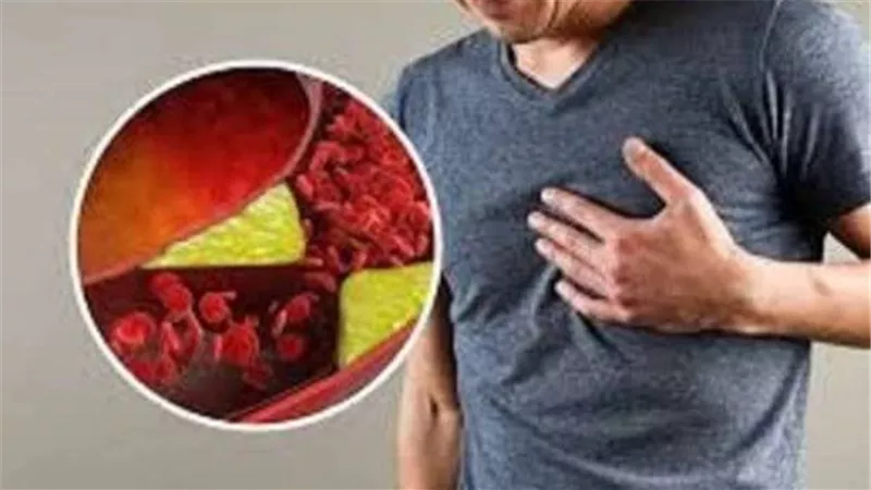 تعرف عليها.. 6 أطعمة صيفية خارقة تخفض مستوى الكوليسترول 