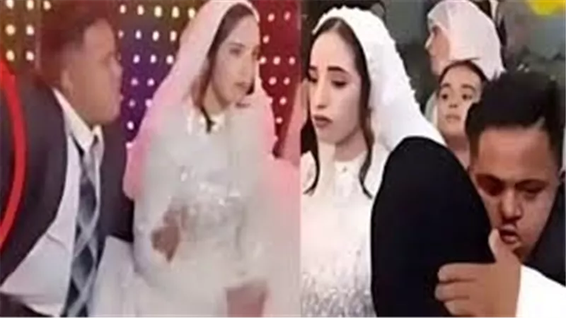 رئيس الاتحاد المصري للإعاقات الذهنية تكشف تفاصيل جديدة بشأن زواج قاصر من مصاب بمتلازمة داون