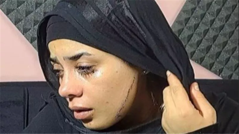  طليقة عريسها شوهت وجهها..حكاية «منصورة» فتاة مصر القديمة | شاهد