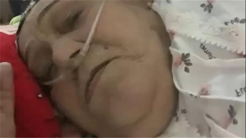  القصة الكاملة.. تفاصيل اعتداء طاقم تمريض على مريضة بالعناية المركزة بمستشفى خاص بطنطا 