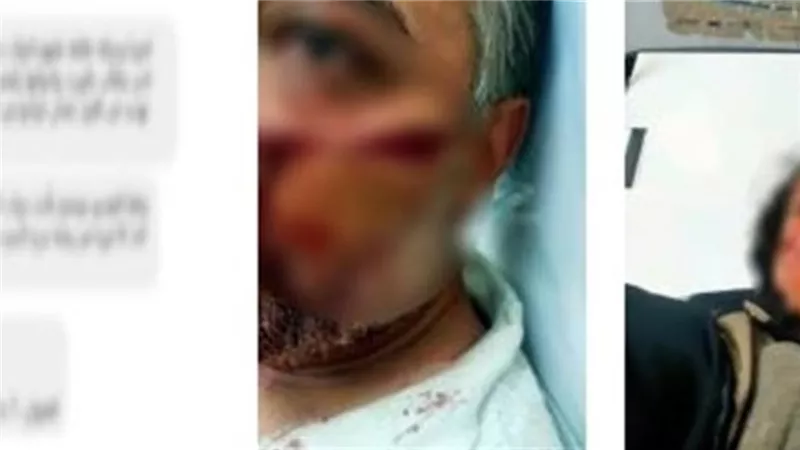  خلاف على الميراث..التفاصيل الكاملة للتعدي على زوجين بالمطرية
