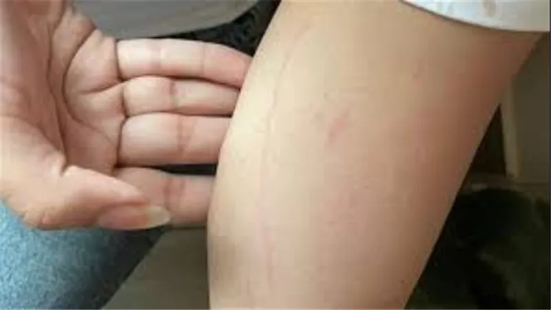  تنمروا على ابنتها لقصر قامتها.. سيدة تحرر محضرا ضد مسئولي مدرسة بالتجمع 