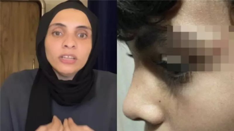 ابني انضرب واتسحل وخايفة أرجع بيتي.. تفاصيل مثيرة جديدة عن خناقة المحمول بمدرسة أكتوبر